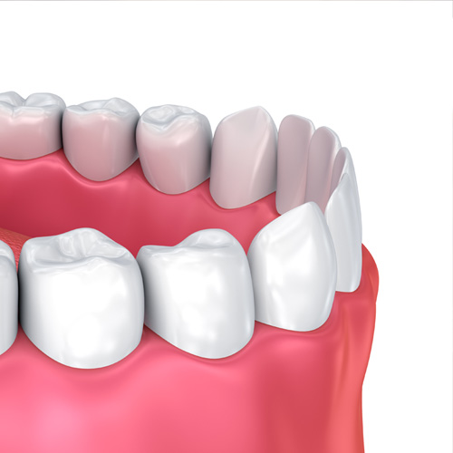 tooth model