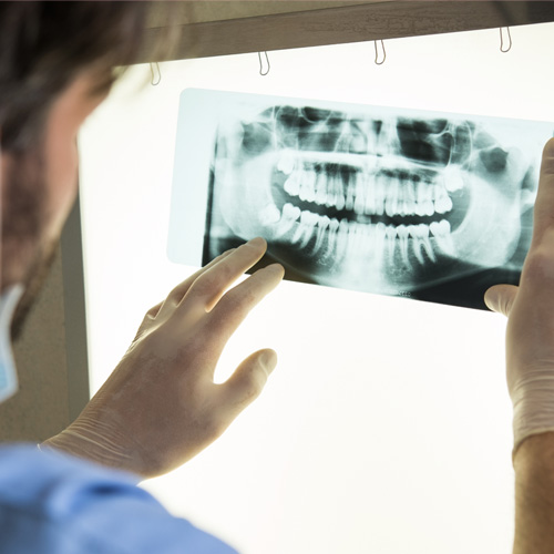 dental xrays