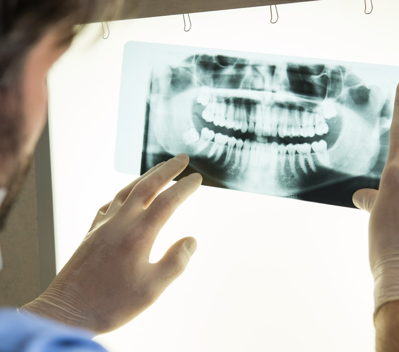 dental xrays