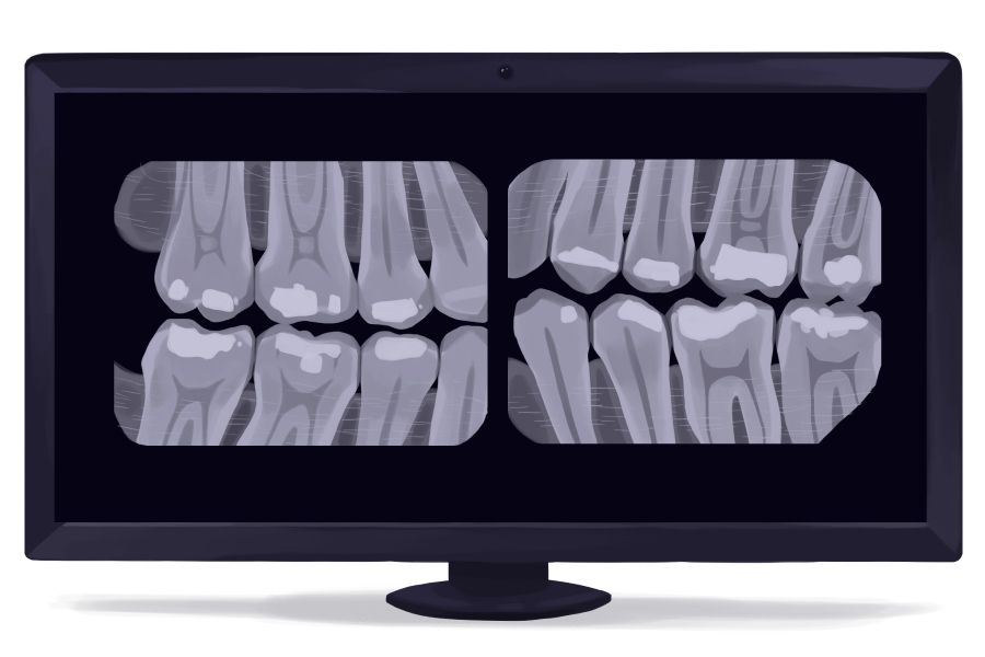 Cartoon image of black and white dental X-rays