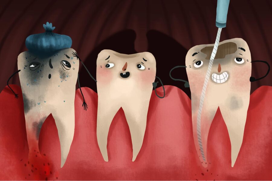 Cartoon image of 3 teeth with different stages of tooth decay