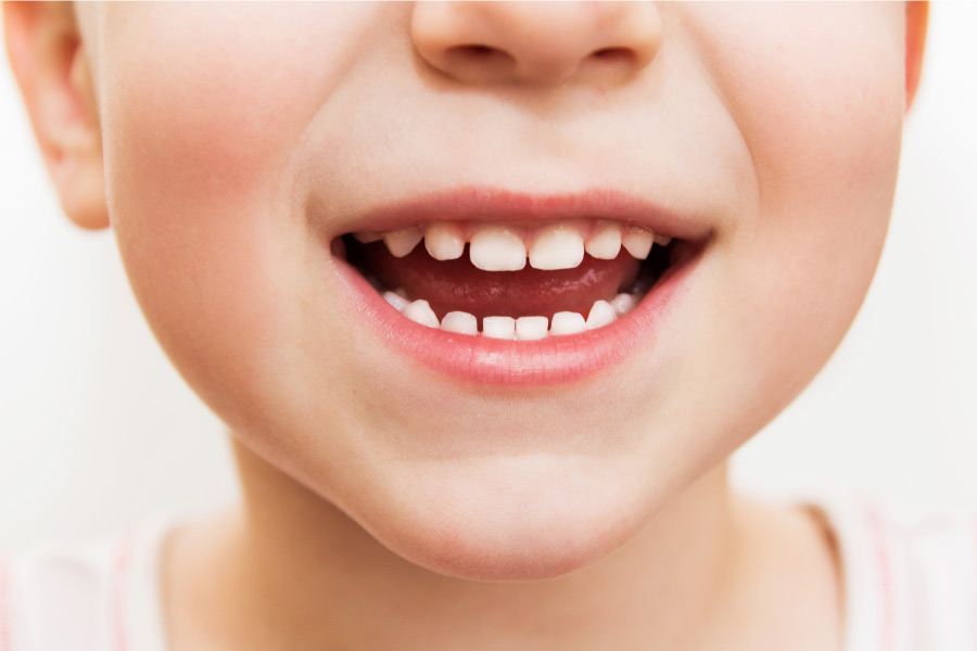 Closeup of a child's smile