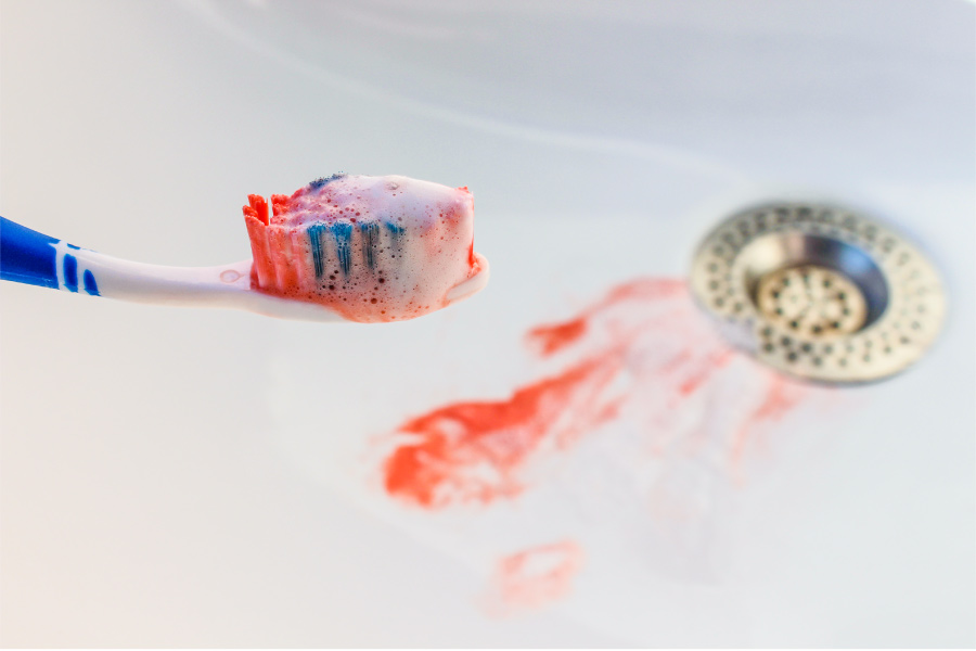 A bloody toothbrush over a sink with blood in the sink from bleeding gums