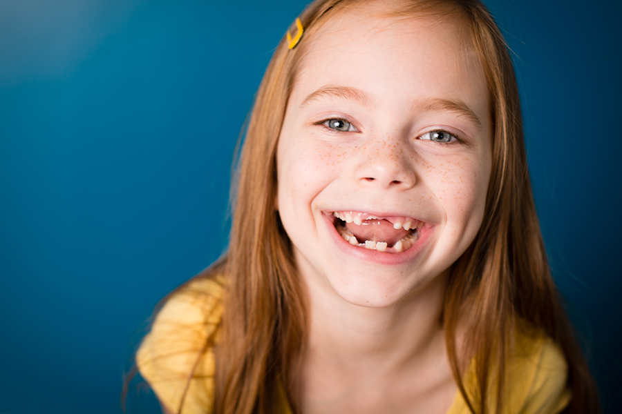 Young girl smiles to show off her missing front teeth after losing her baby teeth